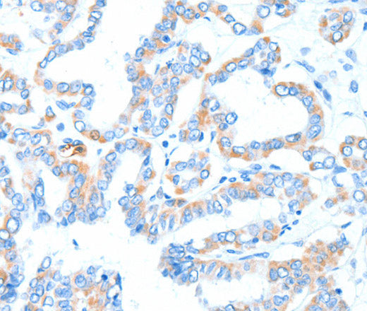 Anti-Human/Mouse/Rat GPT Antibody - ABMIUM