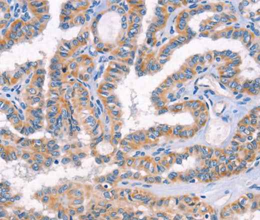 Anti-Human/Mouse/Rat AP1B1 Antibody