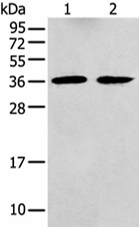 Western blot analysis of Mouse brain tissue and Human fetal brain tissue using GNAI2 Polyclonal Antibody at dilution of 1:400