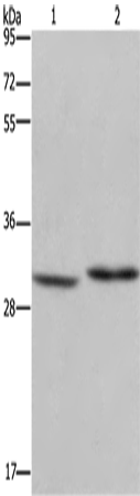 Anti-Human/Mouse DHRS3 Antibody - ABMIUM