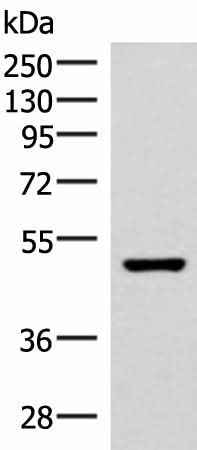 Anti-Human/Mouse/Rat IP6K2 Antibody