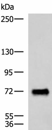 Western blot analysis of Human fetal brain tissue lysate using PPEF1 Polyclonal Antibody at dilution of 1:1500
