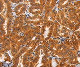 Anti-Human TNFRSF8 Antibody - ABMIUM