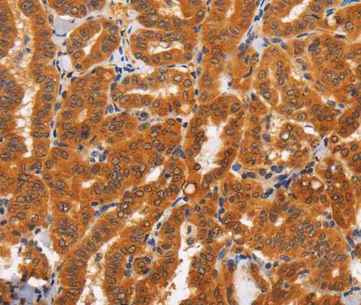 Anti-Human TNFRSF8 Antibody