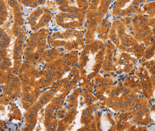 Anti-Human TNFRSF8 Antibody - ABMIUM