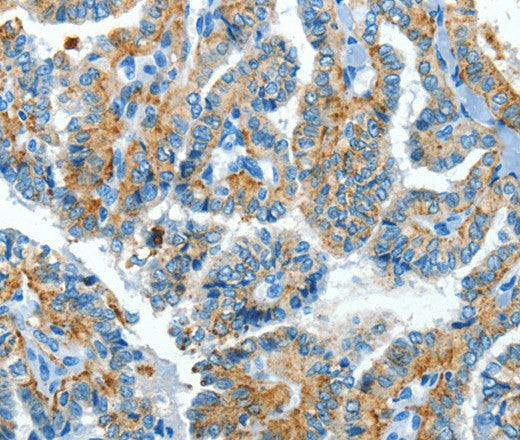 Anti-Human CLPTM1L Antibody - ABMIUM
