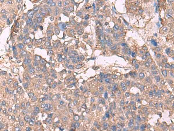 Anti-Human/Mouse/Rat KCNN2 Antibody