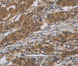 Anti-Human/Mouse/Rat INPPL1 Antibody - ABMIUM