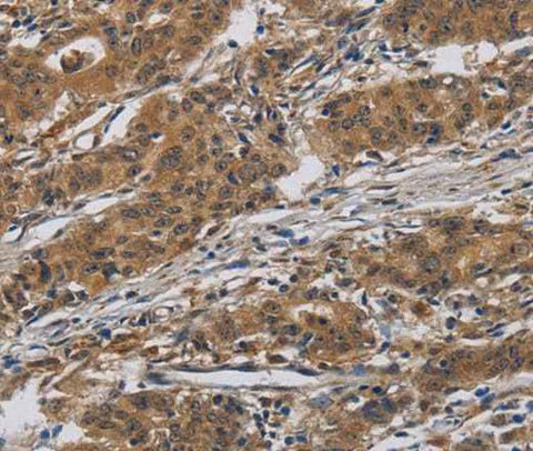 Anti-Human/Mouse/Rat INPPL1 Antibody