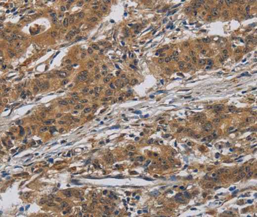 Anti-Human/Mouse/Rat INPPL1 Antibody