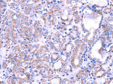 Anti-Human/Mouse SRPK1 Antibody - ABMIUM