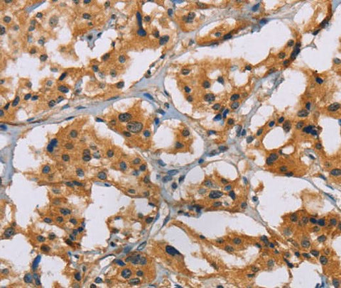 Anti-Human/Mouse/Rat NRN1 Antibody - ABMIUM