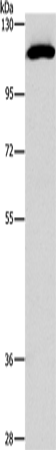 Anti-Human STAT2 Antibody - ABMIUM