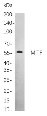Anti-Human/Mouse/Rat MITF Antibody [B836]