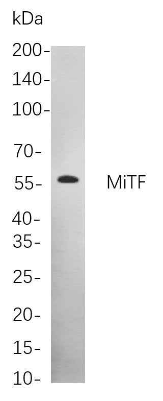 Anti-Human/Mouse/Rat MITF Antibody [B836]