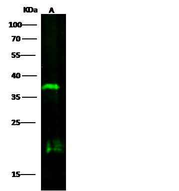 Anti-Human Sox2 Antibody [A1248] - ABMIUM