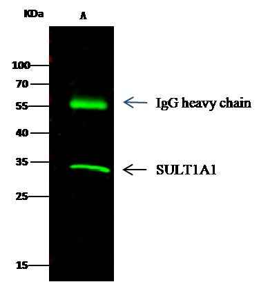 Anti-Human SULT1A1 Antibody [A969] - ABMIUM