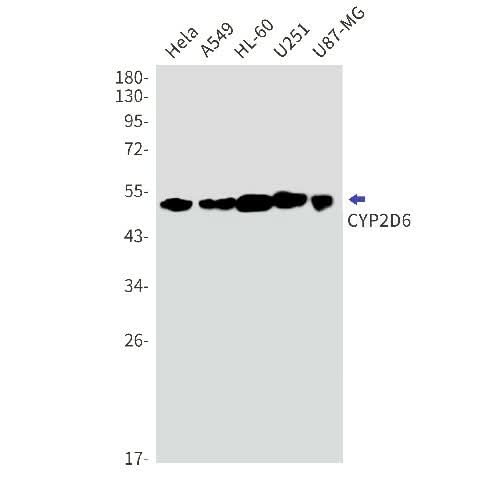 Western blot detection of CYP2D6 in Hela,A549,HL-60,U251,U87-MG cell lysates using CYP2D6 Rabbit mAb(1:1000 diluted).Predicted band size:56kDa.Observed band size:50kDa.