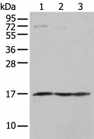 Western blot analysis of Human fetal muscle tissue PC-3 and Jurkat cell using NDUFA12 Polyclonal Antibody at dilution of 1:300