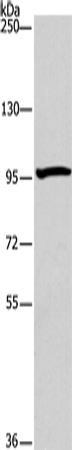 Anti-Human/Rat ATG9A Antibody - ABMIUM