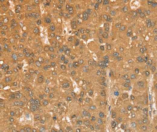 Anti-Human CXCR4 Antibody