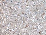Immunohistochemistry of paraffin-embedded Human brain tissue using BMP1 Polyclonal Antibody at dilution of 1:105(×200)