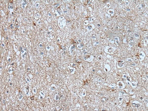 Immunohistochemistry of paraffin-embedded Human brain tissue using BMP1 Polyclonal Antibody at dilution of 1:105(×200)