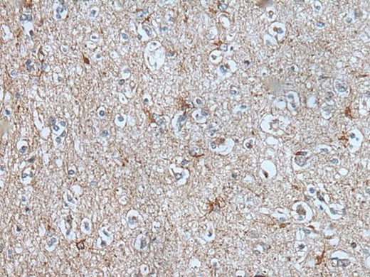 Immunohistochemistry of paraffin-embedded Human brain tissue using BMP1 Polyclonal Antibody at dilution of 1:105(×200)