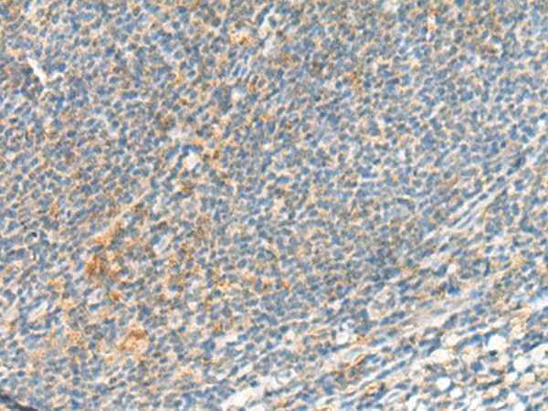 Anti-Human/Mouse/Rat TSHB Antibody