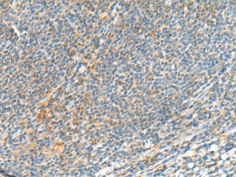Immunohistochemistry of paraffin-embedded Human tonsil tissue using TSHB Polyclonal Antibody at dilution of 1:95(×200)