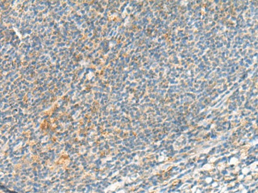 Immunohistochemistry of paraffin-embedded Human tonsil tissue using TSHB Polyclonal Antibody at dilution of 1:95(×200)