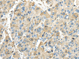 Anti-Human/Mouse/Rat INHBB Antibody - ABMIUM