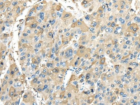 Anti-Human/Mouse/Rat INHBB Antibody - ABMIUM