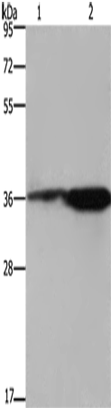 Anti-Human FCAR Antibody - ABMIUM