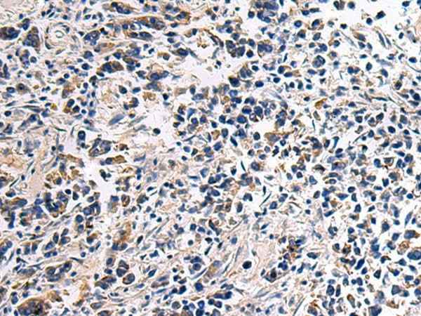 Anti-Human/Mouse/Rat DRGX Antibody