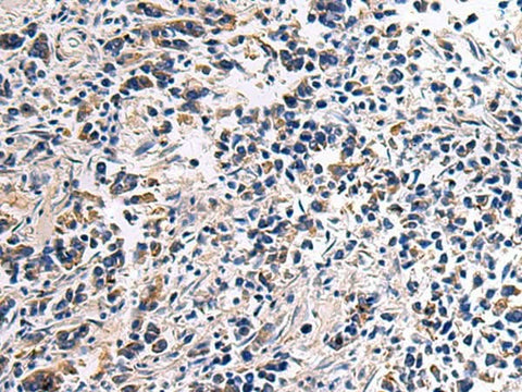 Anti-Human/Mouse/Rat DRGX Antibody - ABMIUM