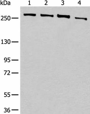 Anti-Human/Mouse PRPF8 Antibody - ABMIUM