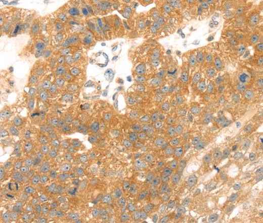 Anti-Human/Mouse TMEFF2 Antibody