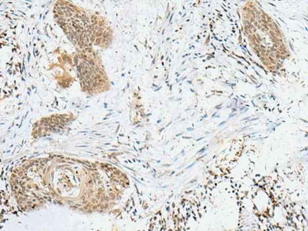 Anti-Human/Mouse/Rat LPXN Antibody