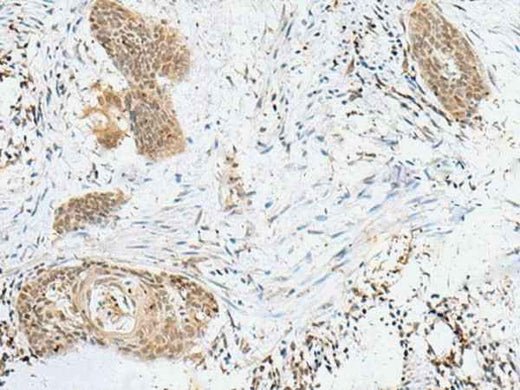 Anti-Human/Mouse/Rat LPXN Antibody
