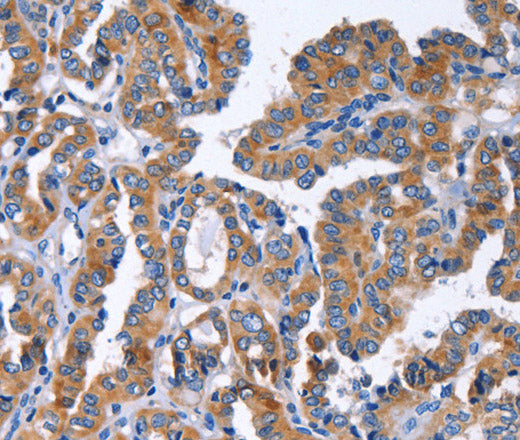 Anti-Human IGSF10 Antibody - ABMIUM