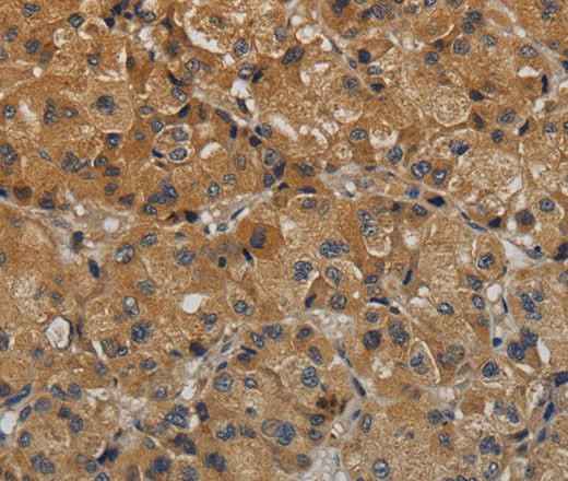 Anti-Human/Mouse TAB1 Antibody