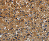 Anti-Human/Mouse TAB1 Antibody - ABMIUM