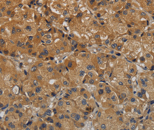 Anti-Human/Mouse TAB1 Antibody - ABMIUM