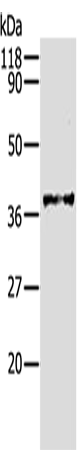 Anti-Human/Mouse/Rat AKR1B1 Antibody - ABMIUM