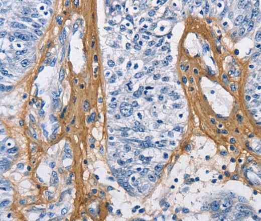 Anti-Human/Mouse/Rat COL3A1 Antibody