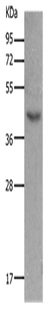 Anti-Human/Mouse MC5R Antibody - ABMIUM