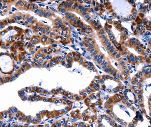 Anti-Human/Mouse FBN1 Antibody