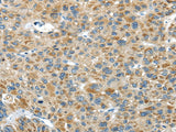 Anti-Human/Mouse USP9X Antibody - ABMIUM