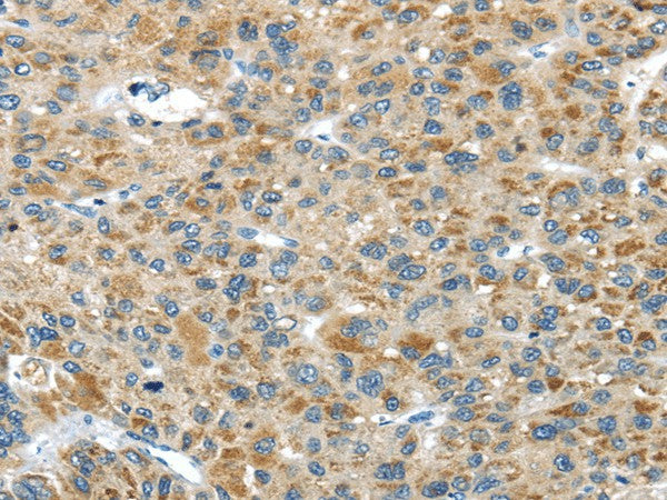 Anti-Human/Mouse USP9X Antibody - ABMIUM